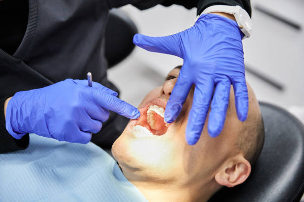 Best Emergency Treatment for Dental Infections or Abscesses in Ferndale, PA